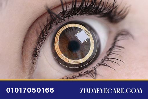 smart lens implants image